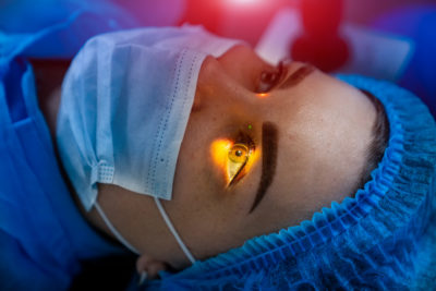 Cataract Surgery